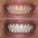 Кокосовий порошок для відбілювання - фото товару teeth26